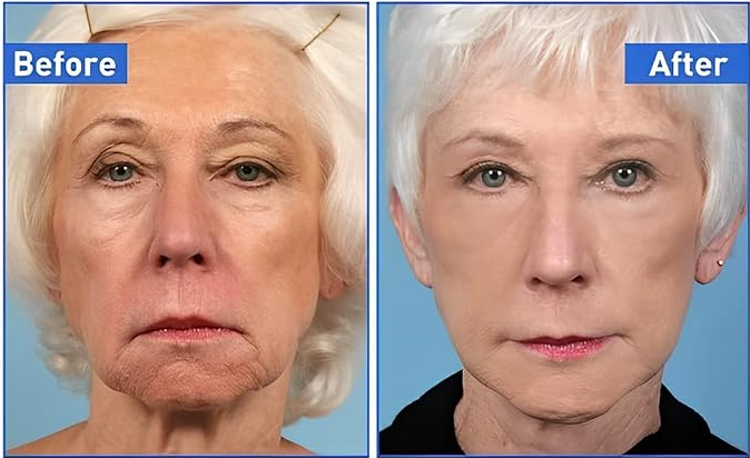Suero Anti-Edad Lazubix – Reafirma, Hidrata y Rejuvenece la Piel