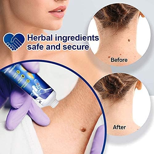 Pomada Removedora de Verrugas Sumifun – Tratamiento Herbal para Verrugas y Lunares