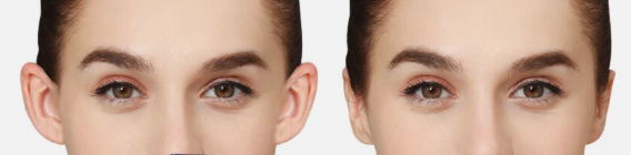 Corrector de Orejas (Ear Corrector)