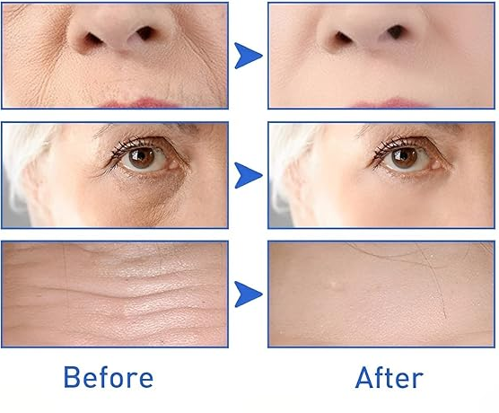 Suero Anti-Edad Lazubix – Reafirma, Hidrata y Rejuvenece la Piel